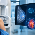 AI analysis of a mammogram to detect cardiovascular disease